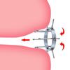 Metal Anal Expander Vaginal Dilator Spreader Huge Speculum Fetish Masturbation Anal Plug Fisting BDSM SM Sex Toys for Men Women Couples