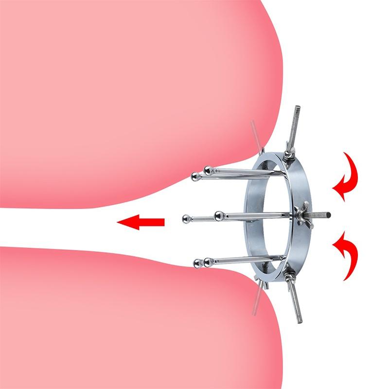Metal Anal Expander Vaginal Dilator Spreader Enorm Speculum Fetish Onani Anal Plug Fisting BDSM SM Sexleketøy for menn Kvinner Par