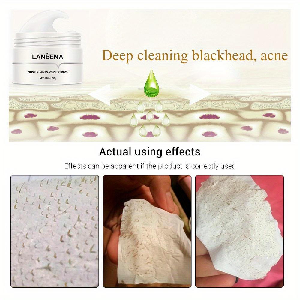 Blackhead Remover Nose Mask Lanbena Pore Strip Black Mask Peeling Acne Treatment Skin Care