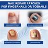Ximonth Toenail Care Repair Patches For Repairing Protecting And Moisturizing Damaged Nails 32 Pcs
