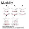 Musiclily 5-Way Metric Lever Switch for Strat/Telecaster Electric Guitars, Black and White Knobs