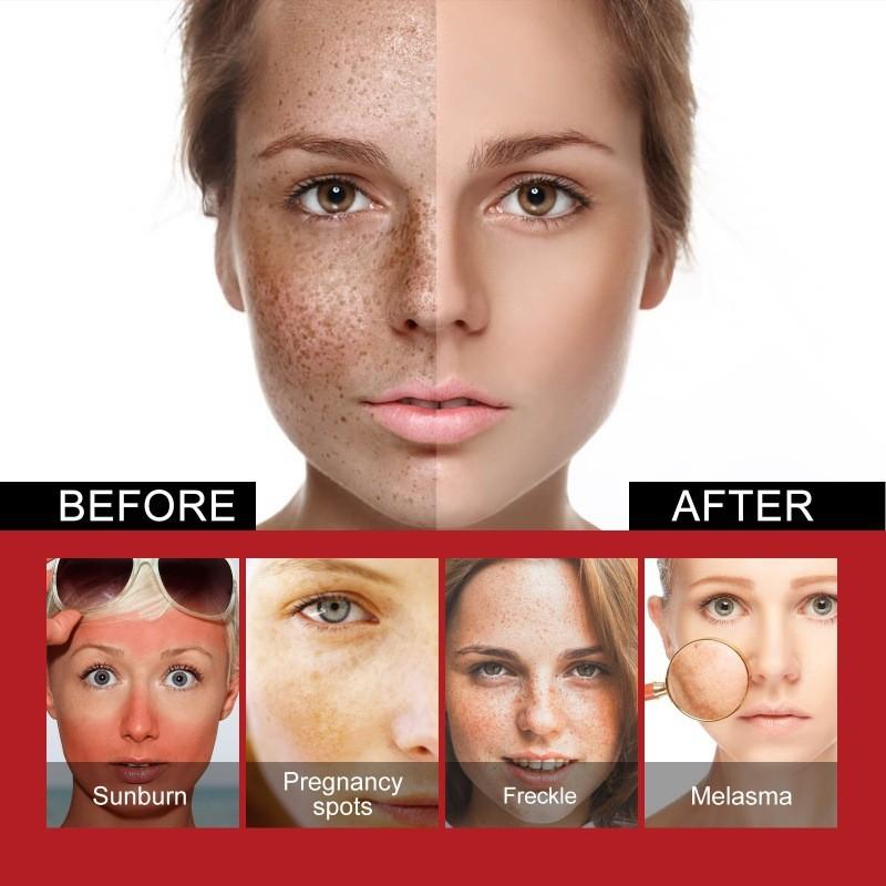 Spot Black Correcting Cream For Radiant Skin Nourishing And Brightening Formula