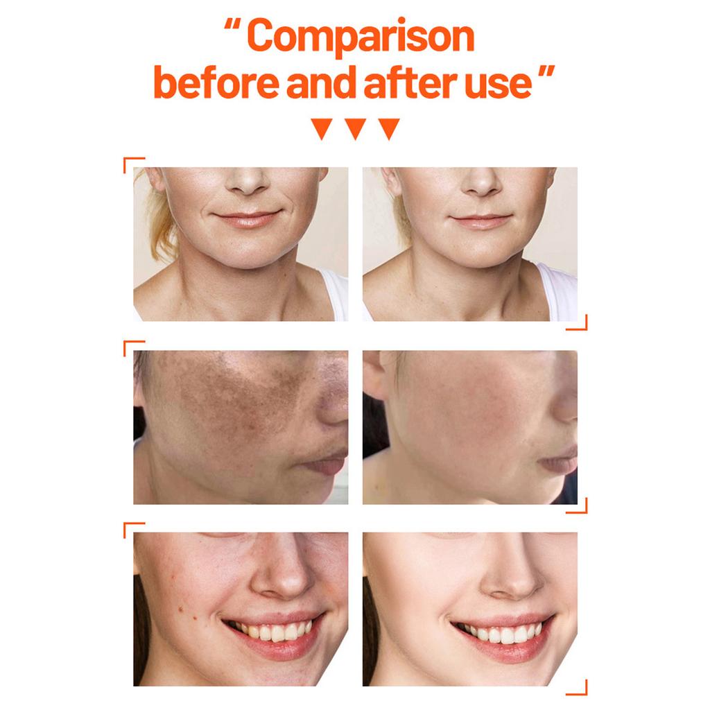 Vitamin C Complete Facial Care Kit Whitening Moisturizing Brighten Vitamin C Face Set for Daily Life