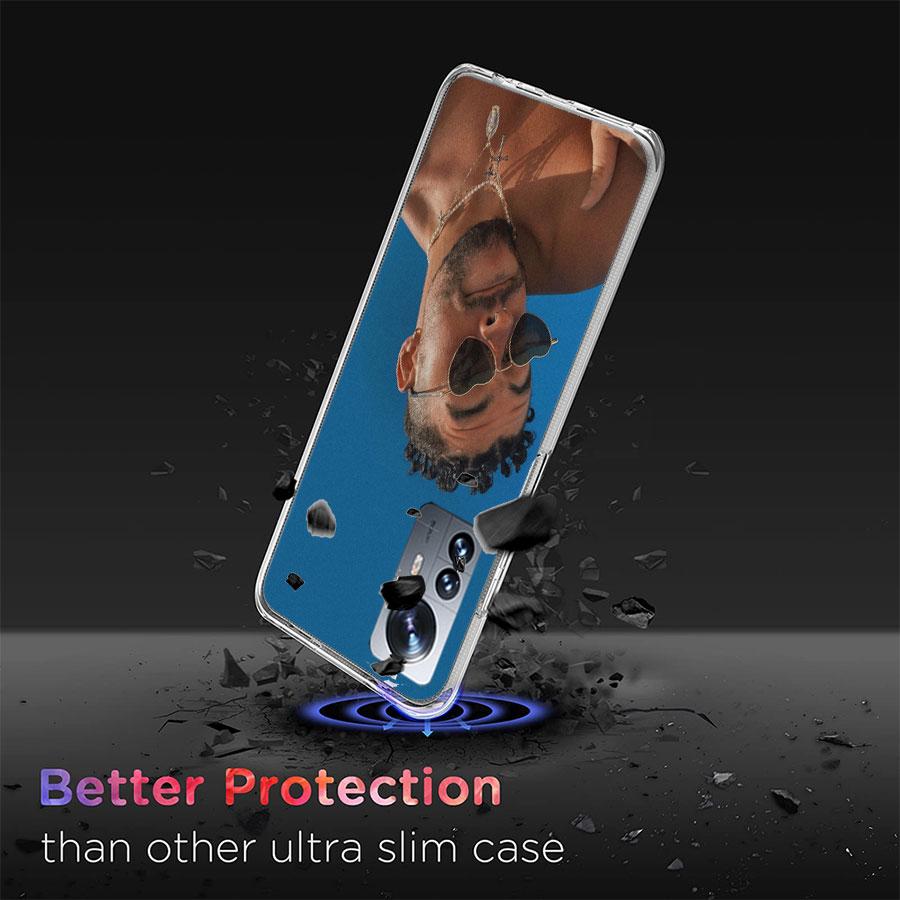 B-Bad B-Bunny Phone Case For Redmi Note 13 Pro Plus 14 Pro+ 12S 12 11S 11T 11E 11 10S 10 9S 9 Xiaomi Capa TPU