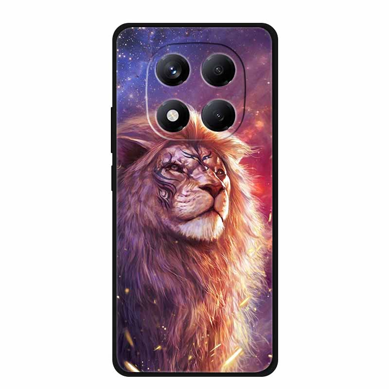 For Redmi Note 15 Case China Version 6.77" Camera Lens Protector Silicone Soft Cover Funda for Redmi Note 15 5G Coque New Note15