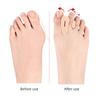 2Pack Orthopedic Toe Separators with Reinforced Forefoot Cushion and Ventilation for Improved Posture and Support