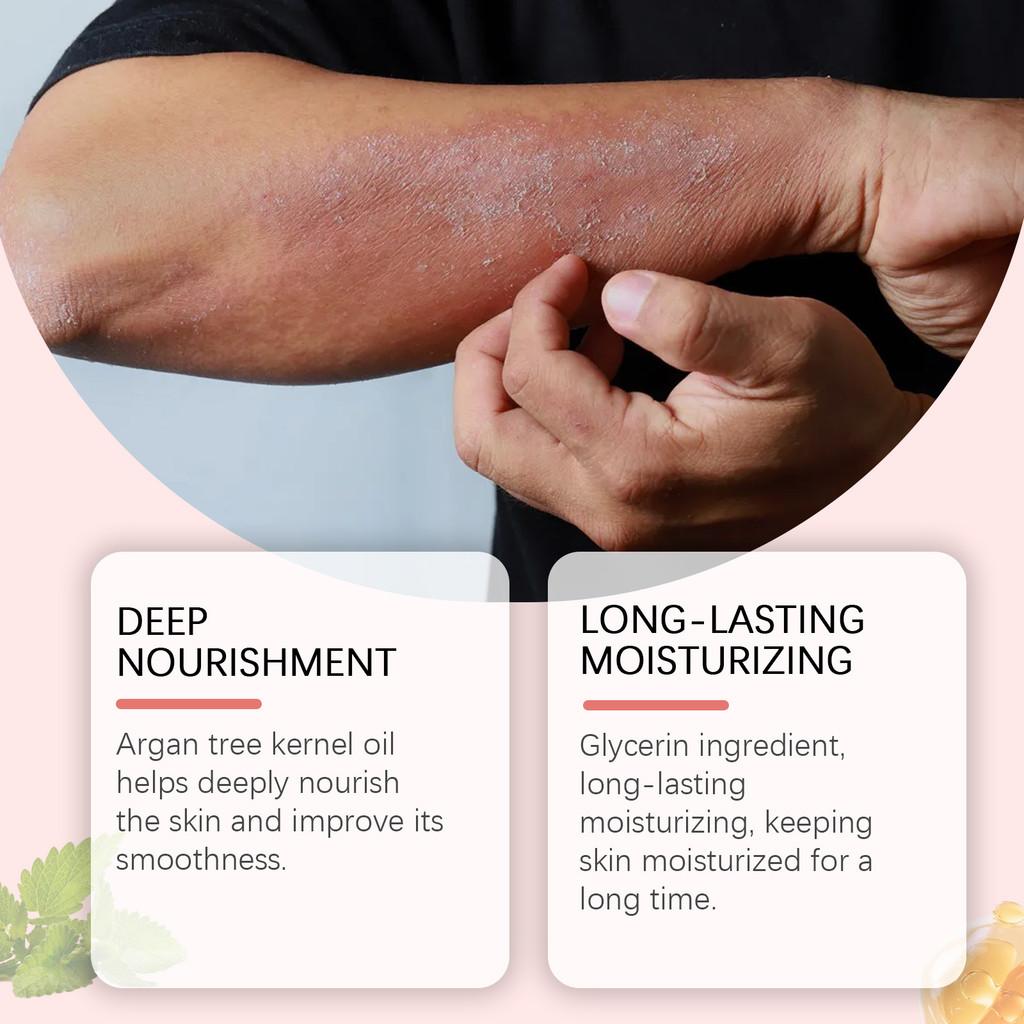 Houkea Skin Repair Cream Ultra Hydrating Moisturizer For Dry And Red Skin 96g