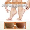 Effective Foot Callus Remover Spray - Softens, Nourishes & Hydrates In Minutes