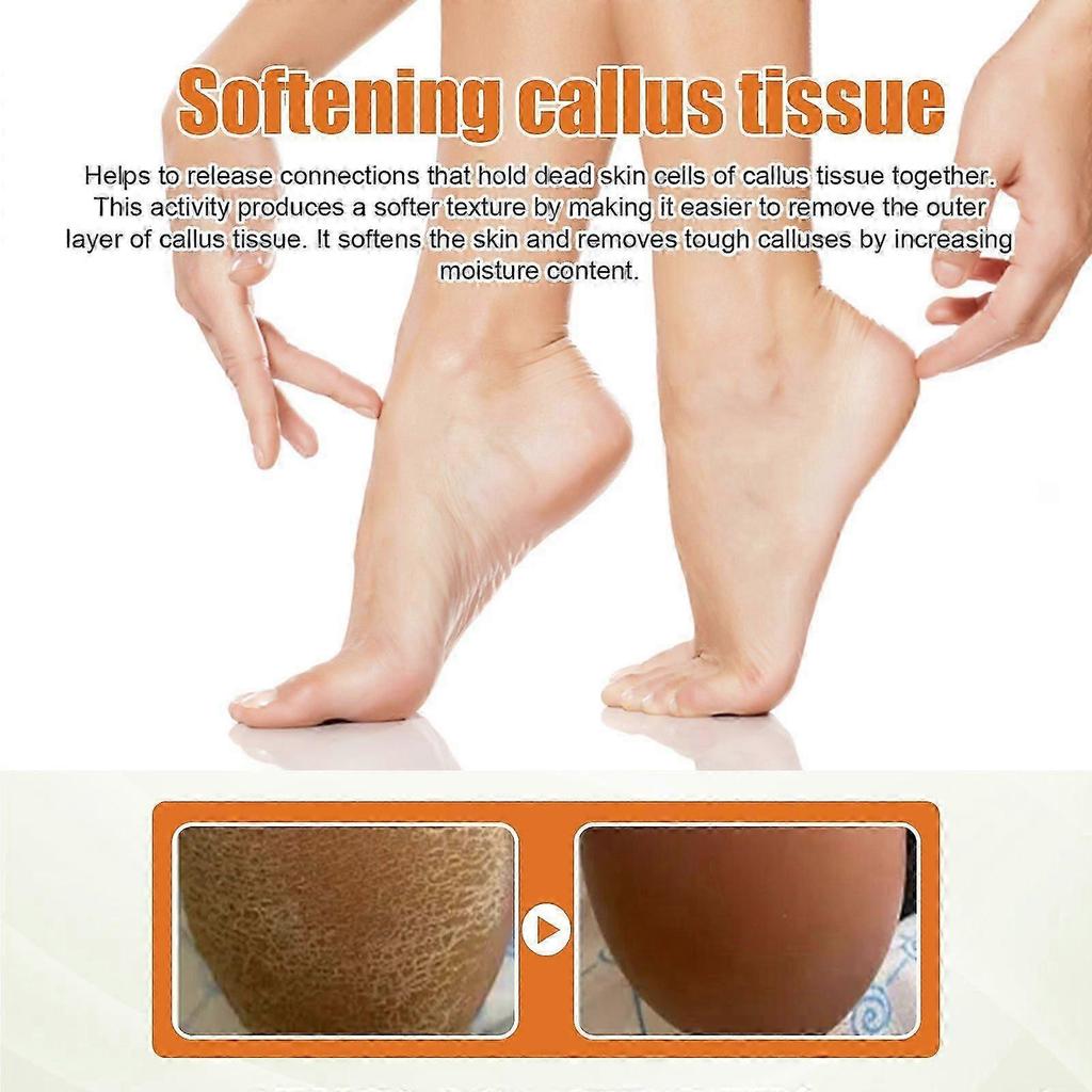 Effective Foot Callus Remover Spray - Softens, Nourishes & Hydrates In Minutes