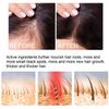 EELHOE Hair Growth Spray Essential Fast Regrowth Serum Beard Growth Oil Hair Loss Care Beauty Hairline Scalp Treatment for Men Women