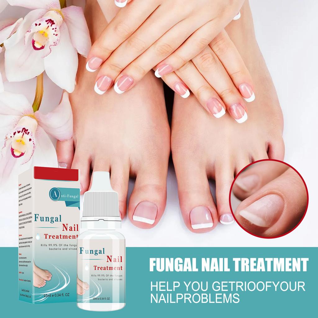 Nail Care Solution, Nail And Toe Care Solution, For Skin Care Nail Nourishing, Fungal Nail Liquid 10ml