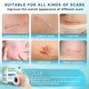 Silicone Scar Tape Reusable Sheet Scars Burns Tummy Chin Keloid Medi Grade for C-section - Cut To Size, 60 Inch