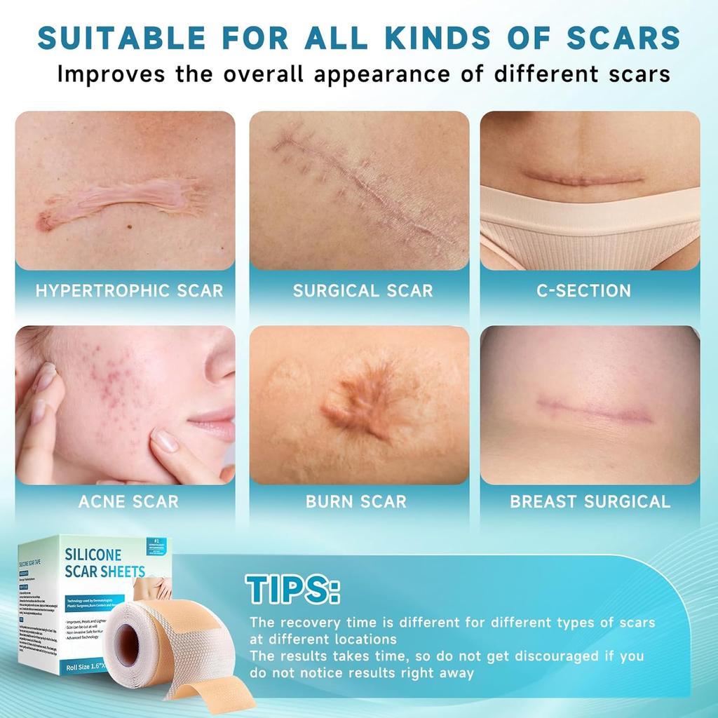 Silicone Scar Tape Reusable Sheet Scars Burns Tummy Chin Keloid Medi Grade for C-section - Cut To Size, 60 Inch