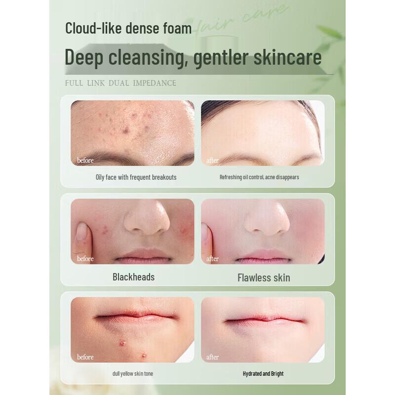 RUYI Detergente Viso Aminoacidi Controllo Grasso e Acne per Giovani