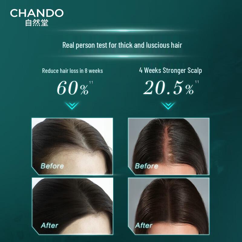 CHANDO Anti-Hair Loss Scalp Essence with Cypress Leaf 120ml