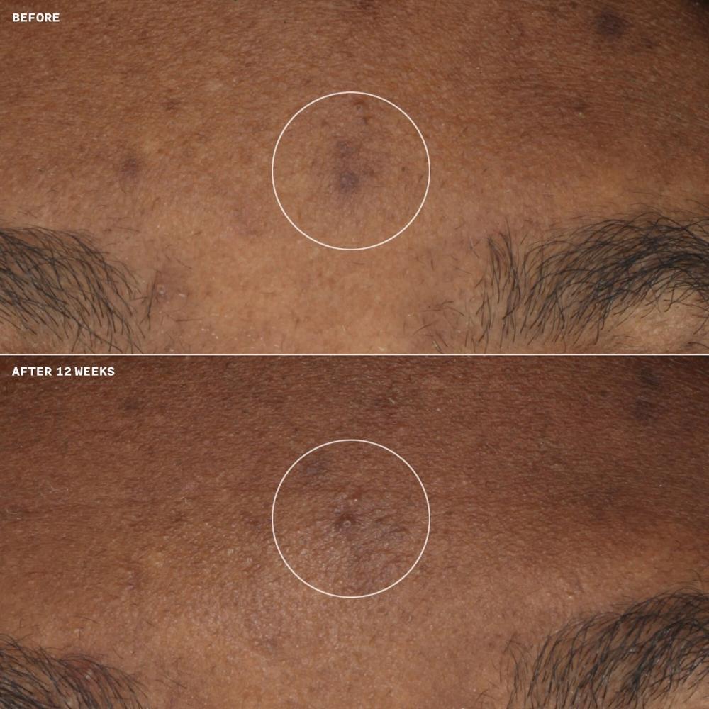 Clinique Even Better Clinical Aufhellende Feuchtigkeitscreme