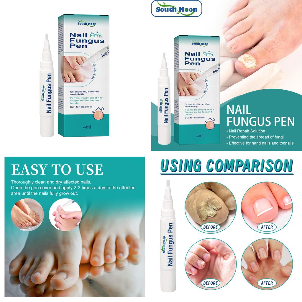 South Moon Nail Repair Pen Nourishing And Cleansing Solution For Thick And Brittle Nails