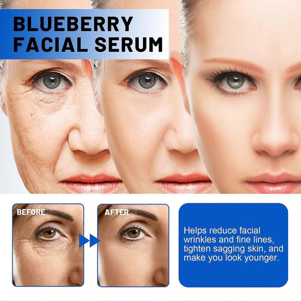 Limited time!!Hoygi Natural Blueberry Anti-Wrinkle Serum Deep Cleansing Anti-Wrinkle Skincare Serum For Brightening And Beautifying Facial Skin Cream