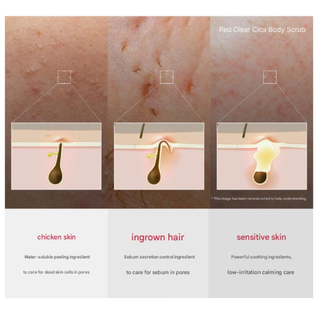 Medicube Red Clear Cica Wash-Off Body Pad 50 Pads (200ml) (3 Options)