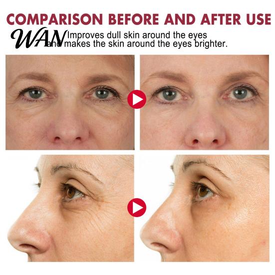 Moisturizing Eye Cream EELHOE Retinol Stick Renewing & Firming Under Balm for Dark Bag Remover Circles, Puffiness, Fine Lines Wrinkles Travel