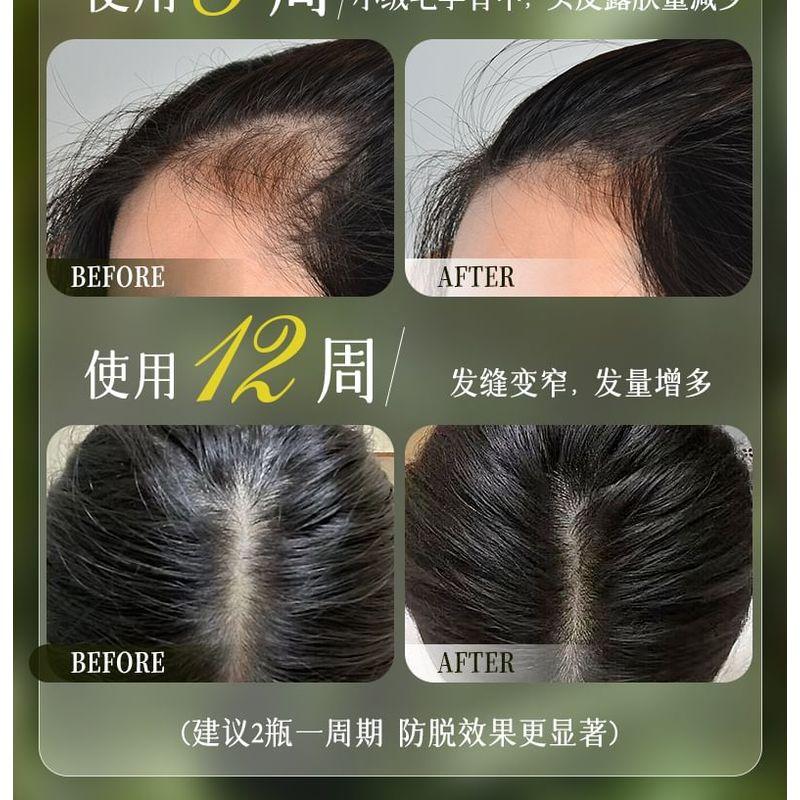 ZOOLY - Nr. 1 Anti-Haarausfall Kopfhautpflege Shampoo - 2 Größen
