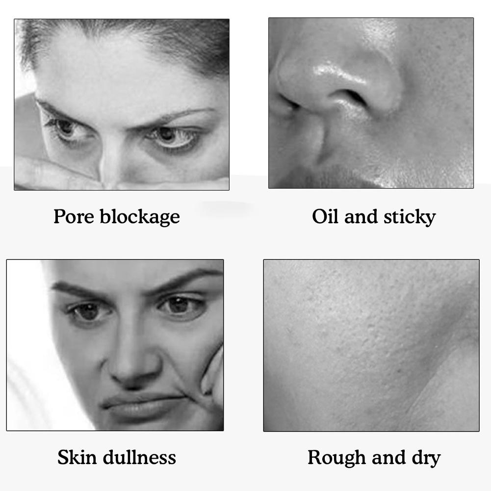 Aloe Vera Exfoliating Gel Peeling Whitening Moisturizing Beauty Skin Improve Care Sunscreen Rep R1O1