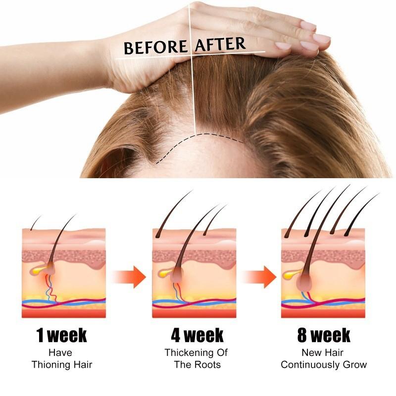 Jaysuing Castor Oil Hair Growth Serum Nourishing Moisturizing Anti Hair Loss 60ml