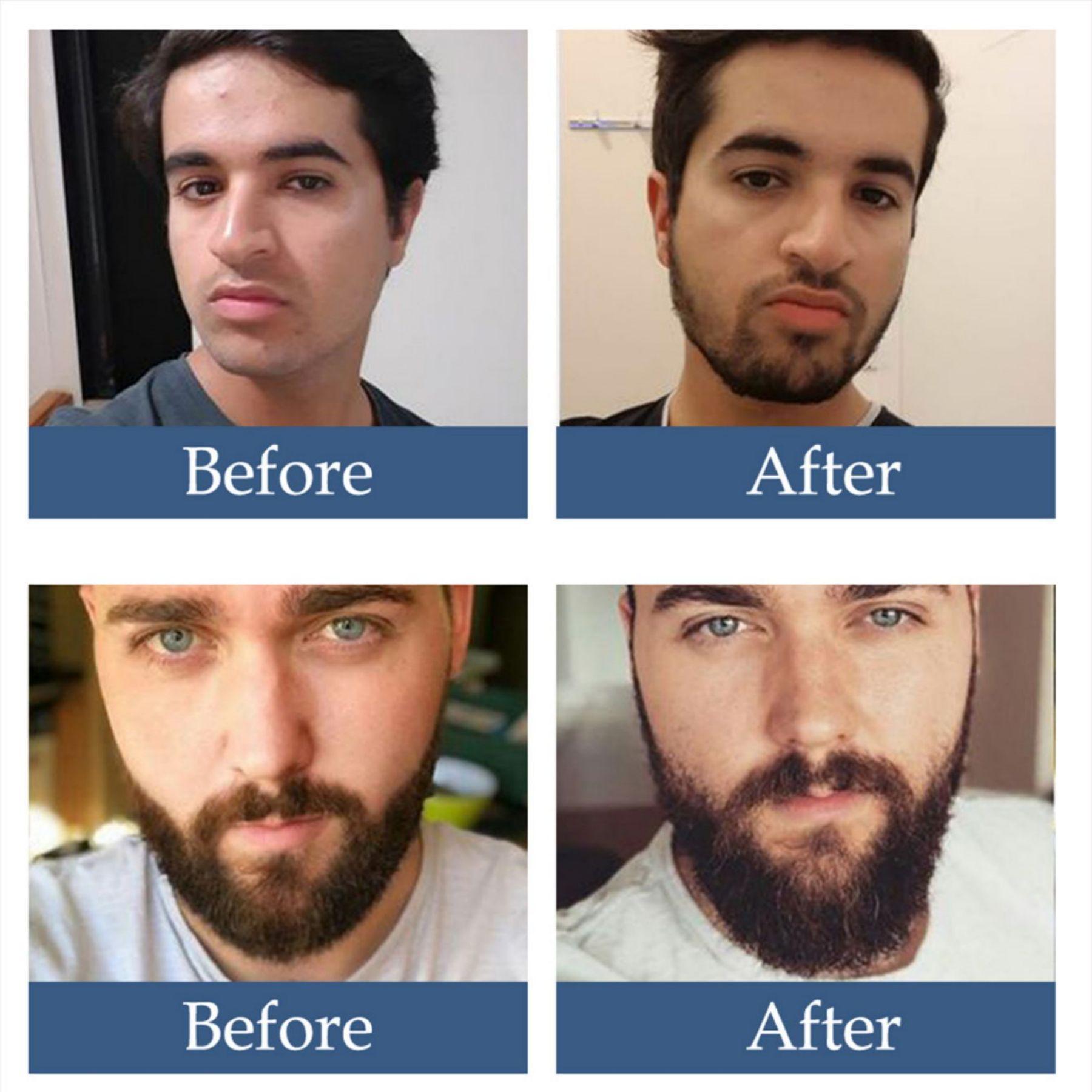 

Масло для волос Beard Oil для быстрого роста волос Рост бороды