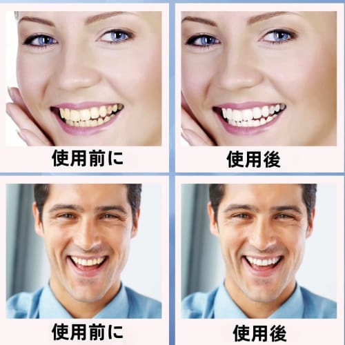 Whitening Sheets, Teeth Whitening Strips, 14-Day Supply, Removes Yellowing, Easy To Brush, 28 Strips Per Pack [Dentist Recommended - Innovative 9D Edi