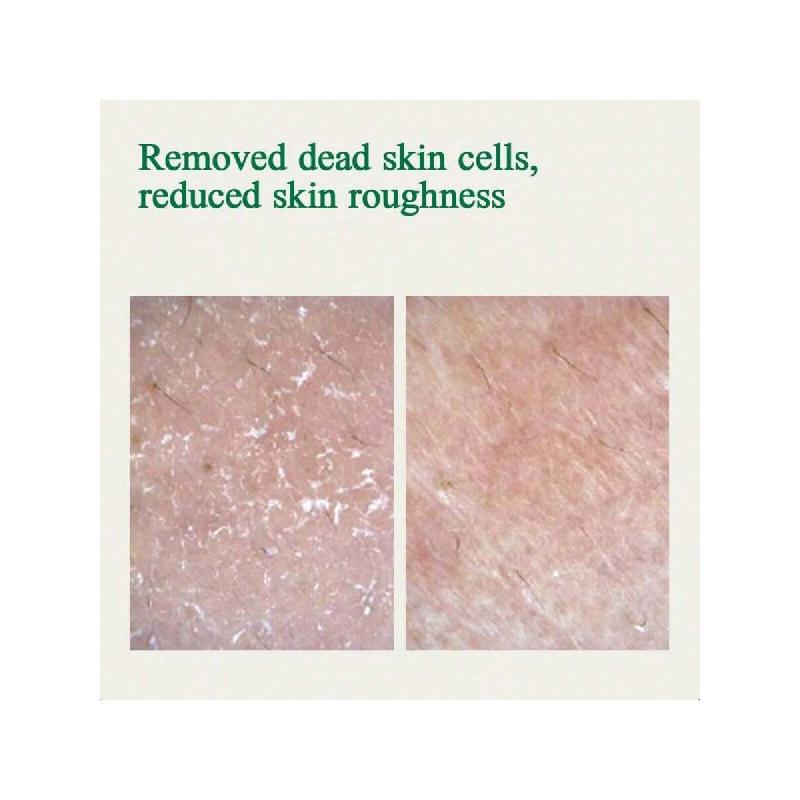 Pyunkang Yul Ultimate Calming Solution Toner With Honeysuckle Flower, Ceramides, Hyaluronic Acid, Centella Asiatica, For Moisturized, 110ml