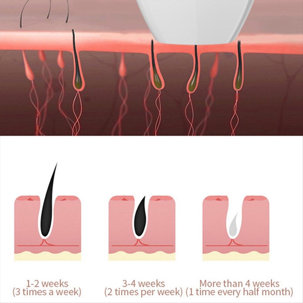 Hair Removal Epilator for Women Flash Depilator LCD Pulses Permanent Epilator Painless Hair Removal,US Plug