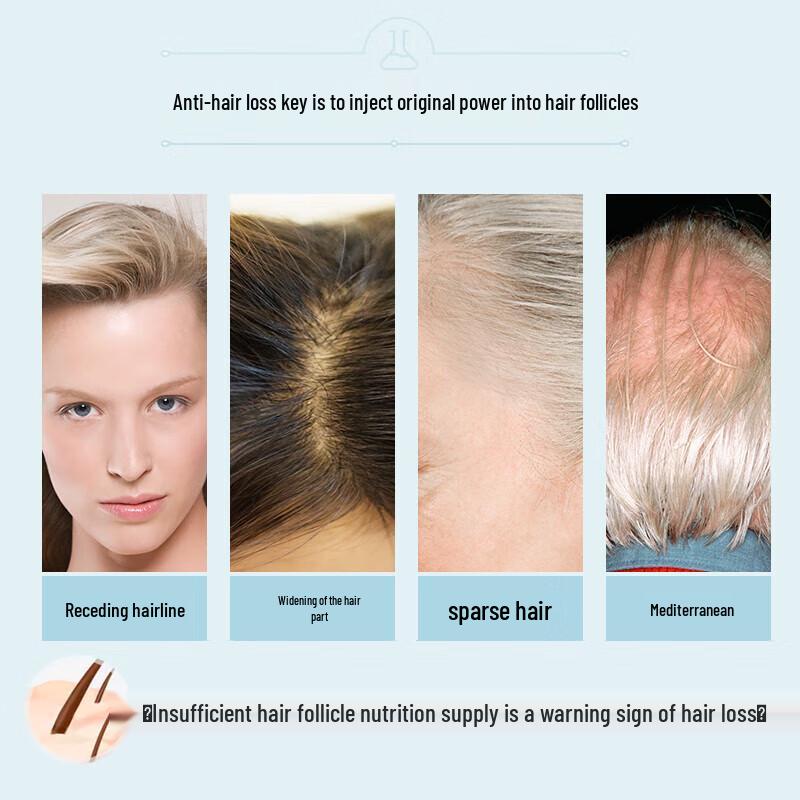 Yangyuanqing Anti-Hair Loss Scalp Treatment (2x50ml)