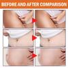 Pregnant Woman Stretch Mark Repair Cream Postpartum Repair and Fade Stretch Marks
