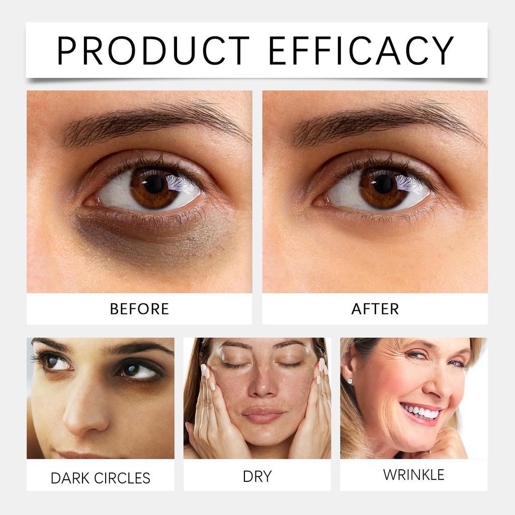 Retinol Augencreme Feuchtigkeitsspendende Und Straffende Augencreme Ist Für Dunkle Augenringe Und Tränensäcke Konzipiert, 50g