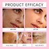 Arbutin Cream Whitening Freckle Cream Smooth Improves Dull Skin Deep Moisturizing Hydrating Face For For Sensitive Skin 202 X9Z6