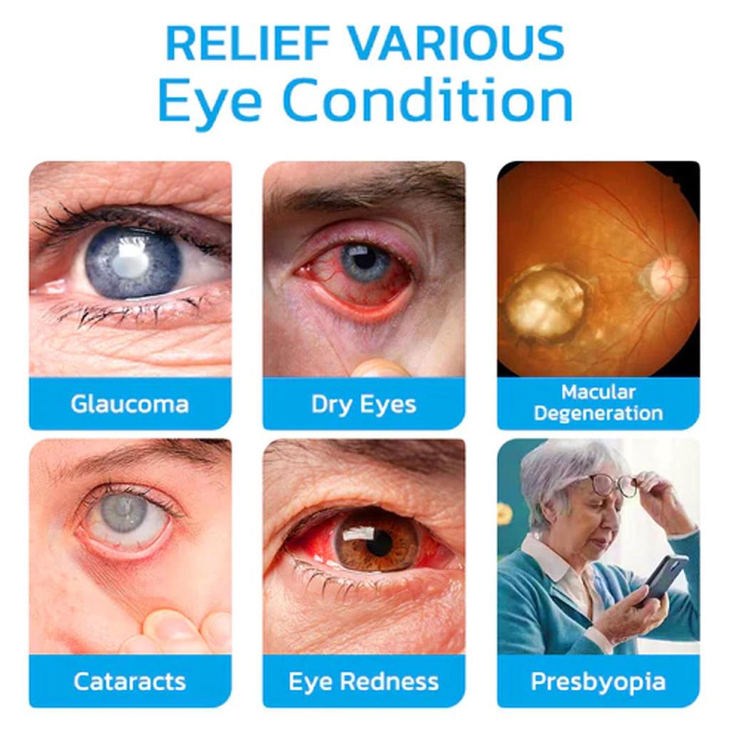 XIMONTH Augenmassage-Roller Lindert Augenbeschwerden Verschwommenes Sehen Feuchtigkeitsspendender Augenmassage-Roller für die Augenpartie