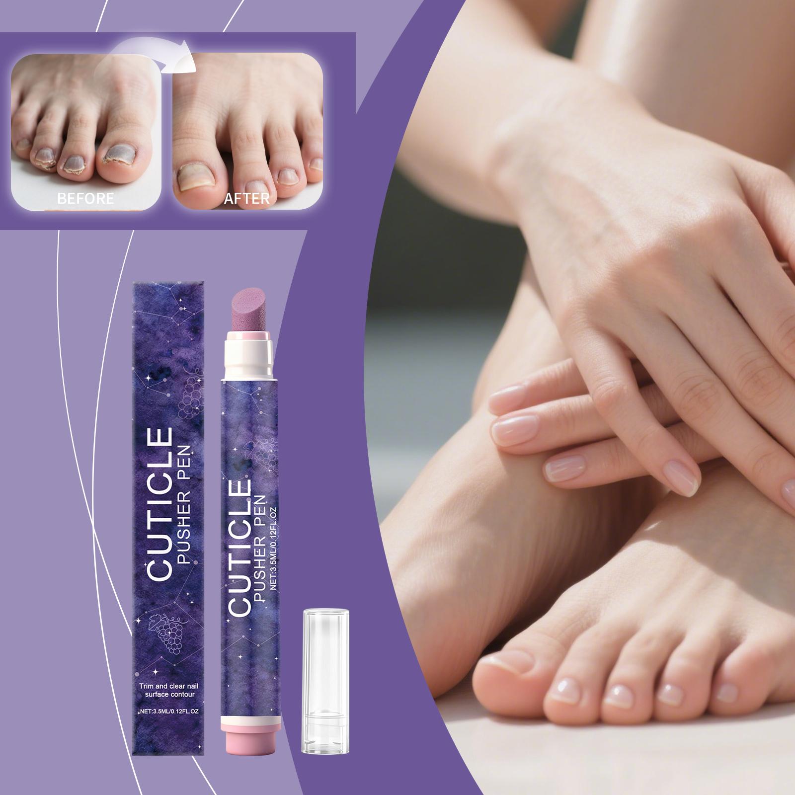 

Многофункциональная ручка для обработки края ногтя удаляет омертвевшую кожу, подстригает края ногтей и обеспечивает уход салонного уровня. 3,5 мл One Size фиолетовый