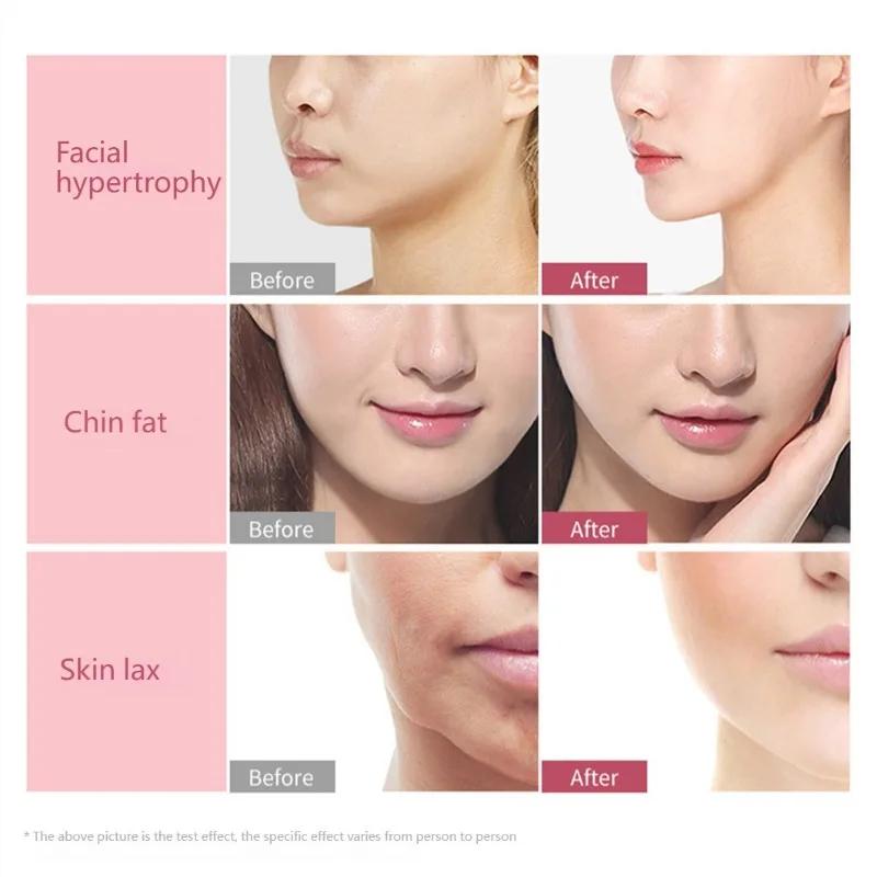 Face Lifting Roller Facial Massager Y Shape Lifting Facial Massager Chin Lift Up Home Use Beauty Instrument Skin Care Tool