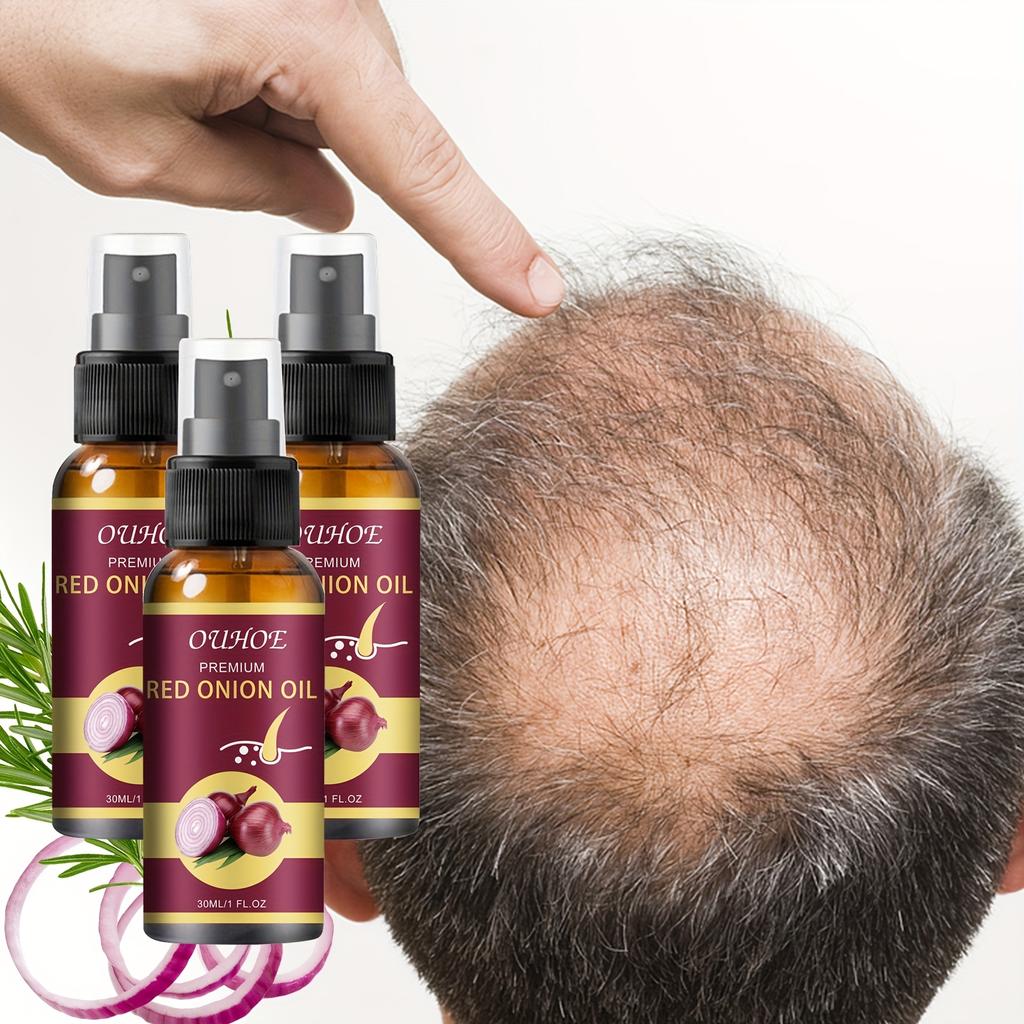 Spray Sérum Puissant pour la Croissance des Cheveux Repousse Cheveux Traitement Anti-Chute Essence Réparatrice Cheveux Nourrit la Racine pour Hommes Femmes Soin Capillaire