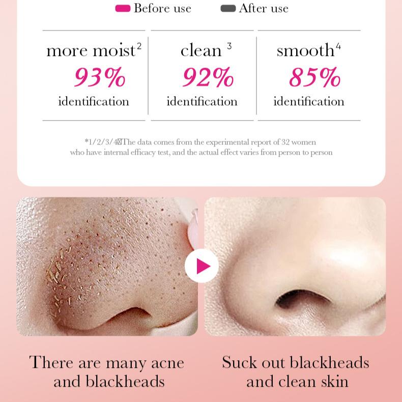 Bamboo Charcoal Ladies Nose Patch SADOER Deep Cleansing Blackhead Removal Nose Mask Patch