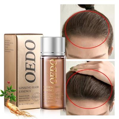 20ml Ätherisches Öl Natürliches Haarwuchsöl - Stimuliert das Haarwachstum, um Haarausfall vorzubeugen