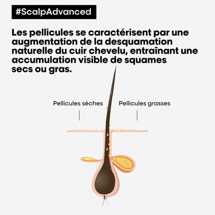 Shampooing Anti-Pelliculaire Scalp Advanced L'Oréal 500ml