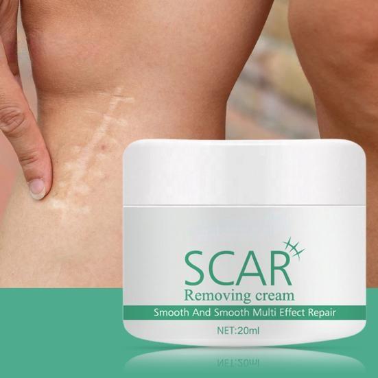 Natürliche Extrakt-Pflanzen-Akne-Stretch-Narben-Entfernungscremes für Sie