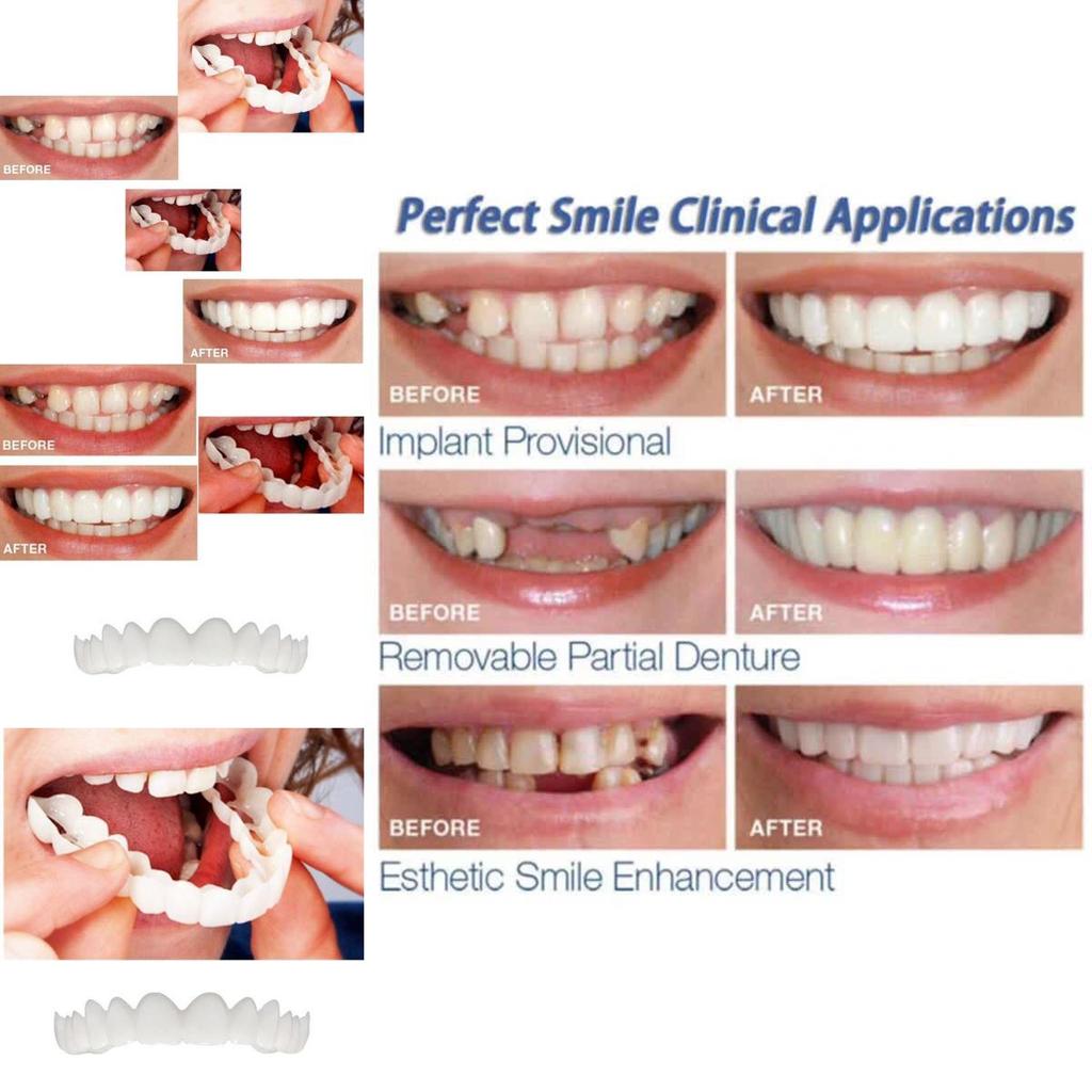 Instant Comfort Smile Cosmetic Teeth Denture Teeth Top Veneer Cosmetic