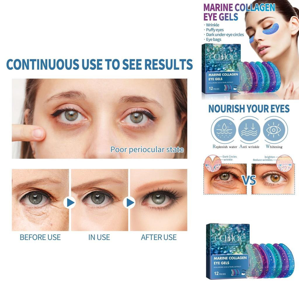 Eelhoe Eye Gel Patches With Hydrating Formula For Reducing Fine Lines And Dark Circles
