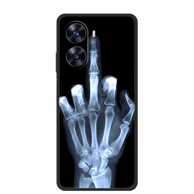For Xiaomi Poco X7 Pro 5G Case Animals Soft Silicone TPU Phone Cases Back Cover for PocoX7 Pro X7Pro Shockproof Protective Capa