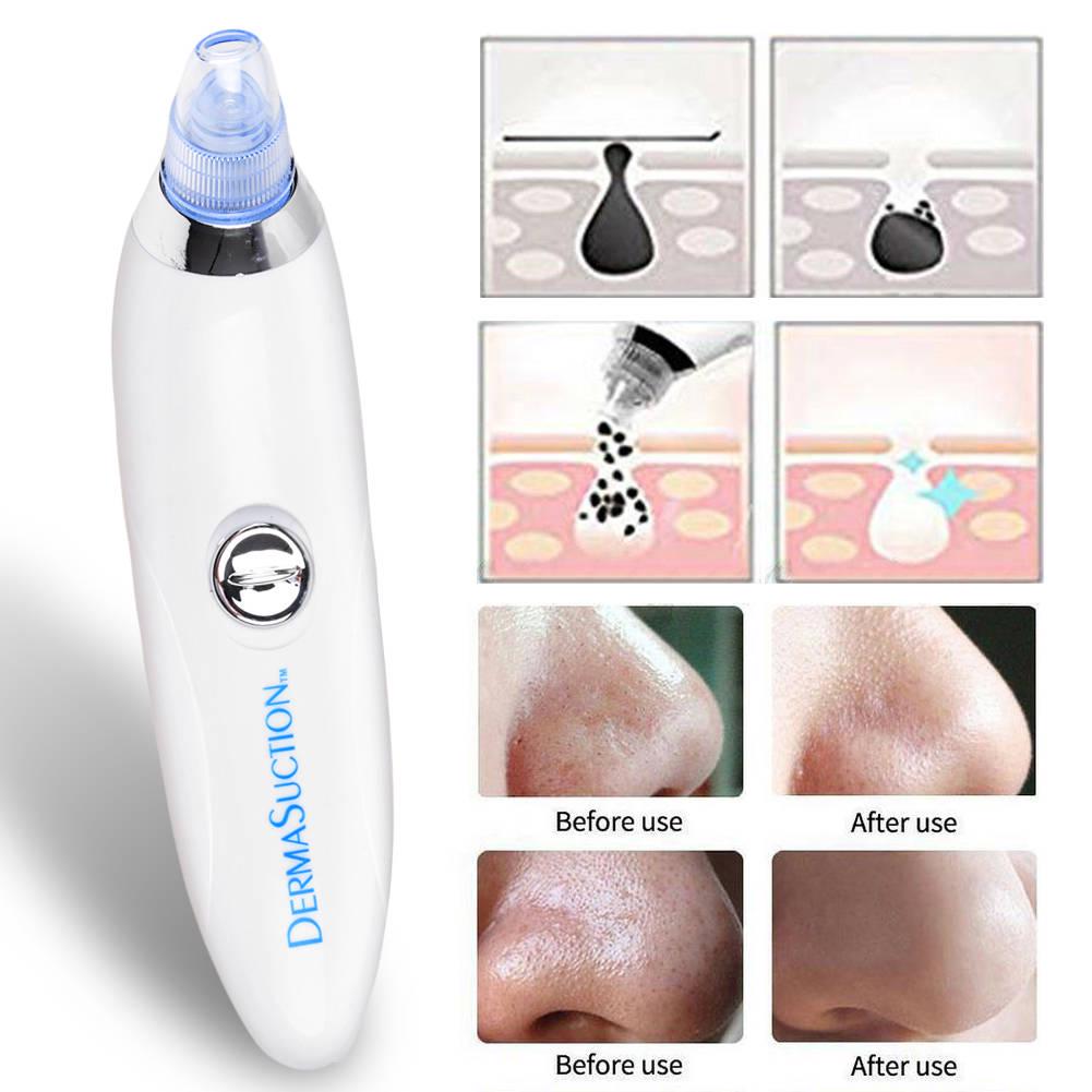 Derma suction насадки. Дерма вакуум. Derma suction 40 kpa vakumlu. Derma suction насадки. Дерма вакуум.