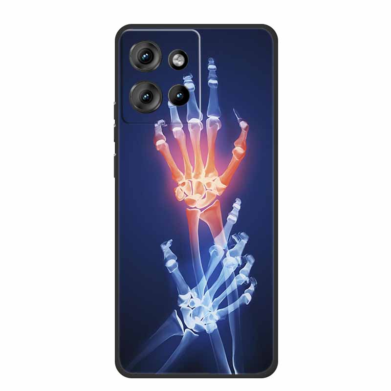 For Motorola Moto G 2025 Case Fashion Flower Black Silicone Soft TPU Back Cover Case For Motorola G75 S50 Edge 50 Neo Phone Case