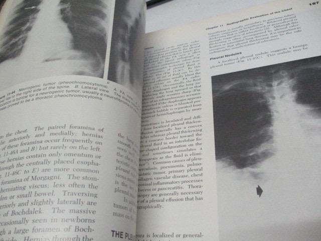 [USED] Hospital disposal book Pulmonary Diseases and Disorders