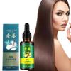 Nourishing Ginger Hair Essence For Healthy And Shiny Locks With Oil Control Benefits